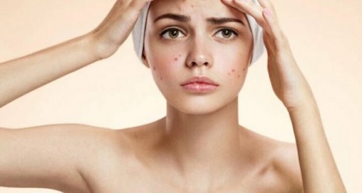 Sai lam cham soc da mat gay mun tram trong (2)