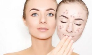 Top 4 bo san pham tri mun duong da duoc ua chuong hien nay