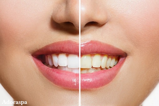 7 Cach tay trang rang tu nhien hieu qua tai nha